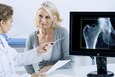 Prevenzione Osteoporosi
